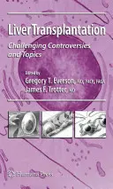 Transplantation hépatique : Controverses et sujets difficiles - Liver Transplantation: Challenging Controversies and Topics