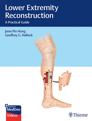 Reconstruction des extrémités inférieures : Un guide pratique - Lower Extremity Reconstruction: A Practical Guide