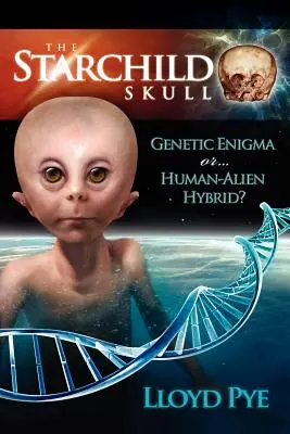 Le crâne de Starchild - Enigme génétique ou hybride humain-alien ? - The Starchild Skull -- Genetic Enigma or Human-Alien Hybrid?