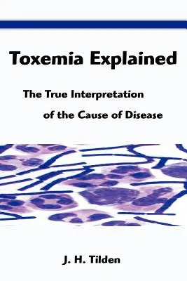 La toxémie expliquée : La véritable interprétation de la cause de la maladie - Toxemia Explained: The True Interpretation of the Cause of Disease