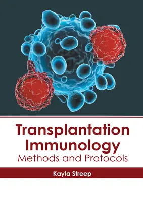 Immunologie de la transplantation : Méthodes et protocoles - Transplantation Immunology: Methods and Protocols