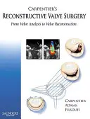 Chirurgie valvulaire reconstructive de Carpentier : De l'analyse à la reconstruction des valves - Carpentier's Reconstructive Valve Surgery: From Valve Analysis to Valve Reconstruction