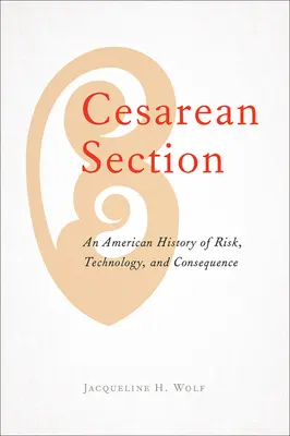 La césarienne : Une histoire américaine du risque, de la technologie et des conséquences - Cesarean Section: An American History of Risk, Technology, and Consequence