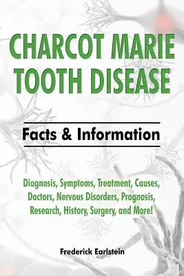 La maladie dentaire de Charcot Marie : Diagnostic, symptômes, traitement, causes, médecins, troubles nerveux, pronostic, recherche, histoire, chirurgie, etc. F - Charcot Marie Tooth Disease: Diagnosis, Symptoms, Treatment, Causes, Doctors, Nervous Disorders, Prognosis, Research, History, Surgery, and More! F