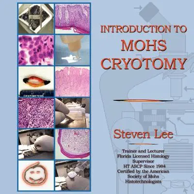 Introduction à la cryotomie MOHS - Introduction to MOHS Cryotomy