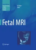 IRM fœtale - Fetal MRI