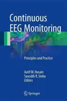 Surveillance continue de l'EEG : Principes et pratique - Continuous Eeg Monitoring: Principles and Practice