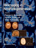 La bio-imagerie dans la neurodégénérescence - Bioimaging in Neurodegeneration