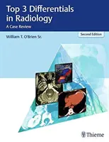 Les trois principaux diagnostics différentiels en radiologie : Une revue de cas - Top 3 Differentials in Radiology: A Case Review