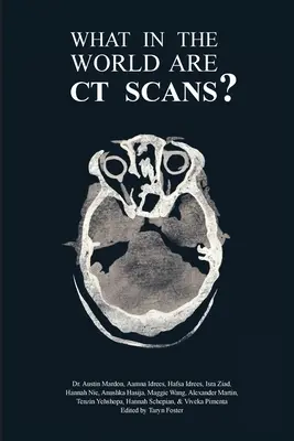 Qu'est-ce que la tomodensitométrie ? - What in the World are CT Scans?