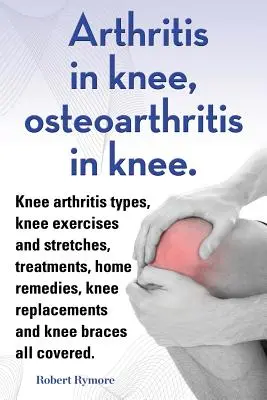 Arthrite du genou, arthrose du genou. Les types d'arthrite du genou, les exercices et étirements du genou, les traitements, les remèdes maison, les remplacements du genou et l'arthrose du genou. - Arthritis in knee, osteoarthritis in knee. Knee arthritis types, knee exercises and stretches, treatments, home remedies, knee replacements and knee b