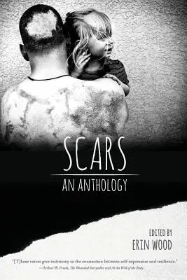 Cicatrices : Une anthologie - Scars: An Anthology