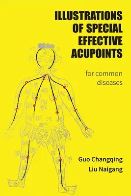 Illustrations de points d'acupuncture spéciaux et efficaces pour les maladies courantes - Illustrations Of Special Effective Acupoints for common Diseases