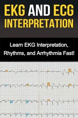 L'ECG et l'interprétation de l'ECG : Apprenez l'interprétation de l'ECG, les rythmes et l'arythmie rapidement ! - EKG and ECG Interpretation: Learn EKG Interpretation, Rhythms, and Arrhythmia Fast!