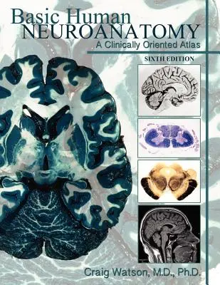 Neuroanatomie humaine de base : Un atlas orienté vers la clinique - Basic Human Neuroanatomy: A Clinically Oriented Atlas