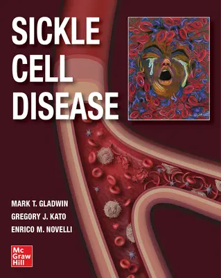 La drépanocytose - Sickle Cell Disease