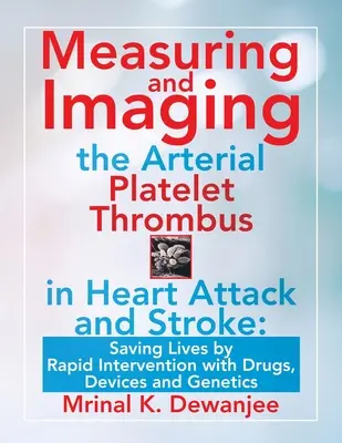 Mesure et imagerie du thrombus plaquettaire artériel en cas de crise cardiaque et d'accident vasculaire cérébral : Sauver des vies par une intervention rapide à l'aide de médicaments, de dispositifs et de la génétique - Measuring and Imaging the Arterial Platelet Thrombus in Heart Attack and Stroke: Saving Lives by Rapid Intervention with Drugs, Devices and Genetics