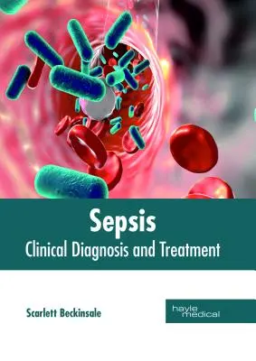 Sepsis : Diagnostic clinique et traitement - Sepsis: Clinical Diagnosis and Treatment