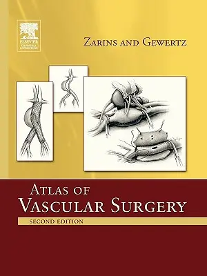 Atlas de la chirurgie vasculaire - édition brochée - Atlas of Vascular Surgery - Paperback Edition