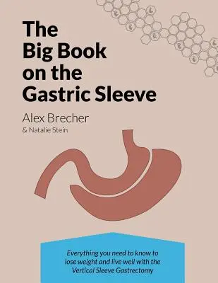 The Big Book on the Gastric Sleeve : Everything You Need to Know to Lose Weight and Live Well with the Vertical Sleeve Gastrectomy (Le grand livre de la Sleeve gastrique : tout ce qu'il faut savoir pour perdre du poids et bien vivre grâce à la Sleeve Gastrectomie verticale) - The Big Book on the Gastric Sleeve: Everything You Need to Know to Lose Weight and Live Well with the Vertical Sleeve Gastrectomy