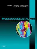 IRM musculo-squelettique - Musculoskeletal MRI