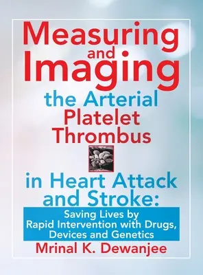 Mesure et imagerie du thrombus plaquettaire artériel en cas de crise cardiaque et d'accident vasculaire cérébral : Sauver des vies par une intervention rapide à l'aide de médicaments, de dispositifs et de la génétique - Measuring and Imaging the Arterial Platelet Thrombus in Heart Attack and Stroke: Saving Lives by Rapid Intervention with Drugs, Devices and Genetics