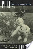 La polio et ses conséquences : La paralysie de la culture - Polio and Its Aftermath: The Paralysis of Culture