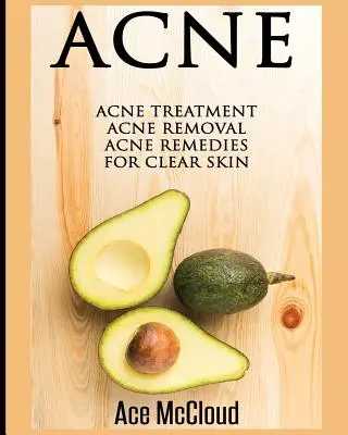 Acné : Traitement de l'acné : L'élimination de l'acné : Remèdes contre l'acné pour une peau nette - Acne: Acne Treatment: Acne Removal: Acne Remedies For Clear Skin