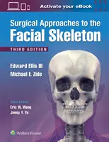 Approches chirurgicales du squelette facial - Surgical Approaches to the Facial Skeleton