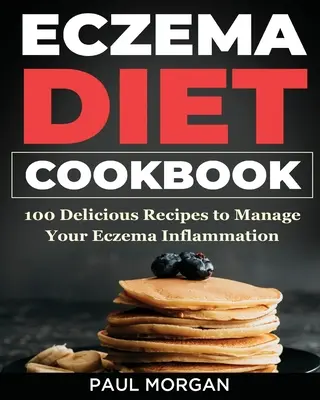 Eczema DIet Cookbook : 100 recettes délicieuses pour gérer l'inflammation due à l'eczéma - Eczema DIet Cookbook: 100 Delicious Recipes to Manage your Eczema Inflammation