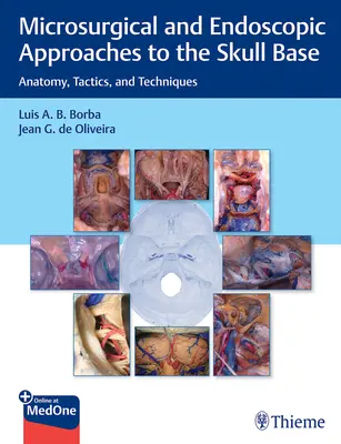 Approches microchirurgicales et endoscopiques de la base du crâne : Anatomie, tactiques et techniques - Microsurgical and Endoscopic Approaches to the Skull Base: Anatomy, Tactics, and Techniques