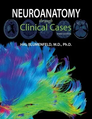 La neuroanatomie à travers des cas cliniques - Neuroanatomy Through Clinical Cases