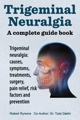 Névralgie du trijumeau : un guide complet. Névralgie du trijumeau : causes, symptômes, traitements, chirurgie, - Trigeminal neuralgia: a complete guide book. Trigeminal neuralgia: causes, symptoms, treatments, surgery,