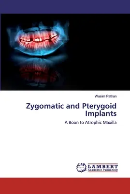 Implants zygomatiques et ptérygoïdiens - Zygomatic and Pterygoid Implants