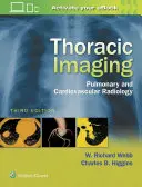 Imagerie thoracique : Radiologie pulmonaire et cardiovasculaire - Thoracic Imaging: Pulmonary and Cardiovascular Radiology