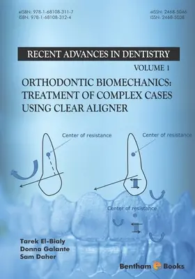 Biomécanique orthodontique : Traitement des cas complexes à l'aide de l'aligneur transparent - Orthodontic Biomechanics: Treatment Of Complex Cases Using Clear Aligner