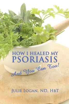 Comment j'ai guéri mon psoriasis : Et vous aussi&nbsp;! - How I Healed My Psoriasis: And You Can Too!