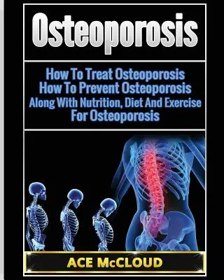 Ostéoporose : Comment traiter l'ostéoporose : Comment prévenir l'ostéoporose : Le traitement de l'ostéoporose : Comment traiter l'ostéoporose ? - Osteoporosis: How To Treat Osteoporosis: How To Prevent Osteoporosis: Along With Nutrition, Diet And Exercise For Osteoporosis