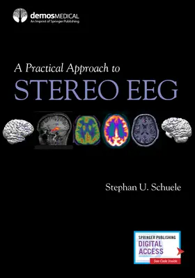 Une approche pratique de l'EEG stéréo - A Practical Approach to Stereo Eeg