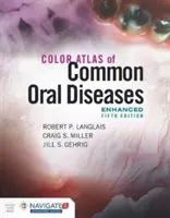 Atlas en couleur des maladies bucco-dentaires courantes, édition améliorée - Color Atlas of Common Oral Diseases, Enhanced Edition