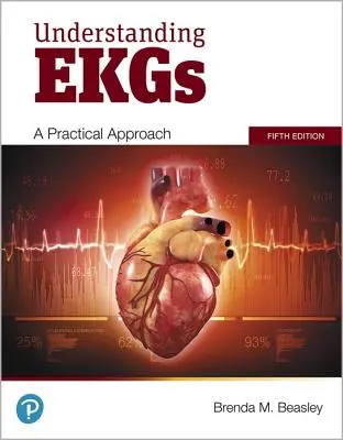 Comprendre les électrocardiogrammes : une approche pratique - Understanding EKGs: A Practical Approach