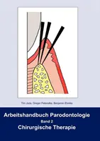 Arbeitshandbuch Parodontologie : Band 2 Chirurgische Therapie - Arbeitshandbuch Parodontologie: Band 2 Chirurgische Therapie