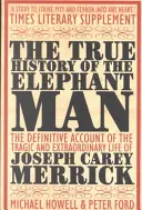 La véritable histoire d'Elephant Man - True History of the Elephant Man