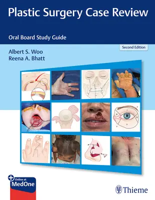 Examen de cas de chirurgie plastique : Guide d'étude de l'examen oral - Plastic Surgery Case Review: Oral Board Study Guide