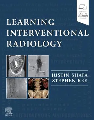 Apprendre la radiologie interventionnelle - Learning Interventional Radiology