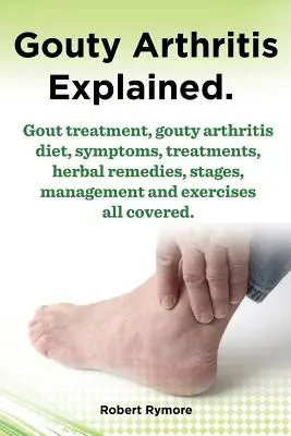 L'arthrite goutteuse expliquée. Traitement de la goutte, régime alimentaire de l'arthrite goutteuse, symptômes, traitements, remèdes à base de plantes, étapes, gestion et exercices, tout est couvert. - Gouty Arthritis Explained. Gout Treatment, Gouty Arthritis Diet, Symptoms, Treatments, Herbal Remedies, Stages, Management and Exercises All Covered.