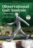 L'analyse observationnelle de la démarche : Un guide visuel - Observational Gait Analysis: A Visual Guide