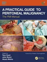 Guide pratique de la malignité péritonéale : Le manuel PMI - A Practical Guide to Peritoneal Malignancy: The PMI Manual