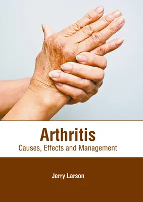 L'arthrite : Causes, effets et prise en charge - Arthritis: Causes, Effects and Management