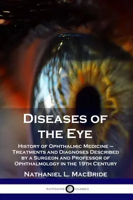 Maladies de l'oeil : Histoire de la médecine ophtalmologique - Traitements et diagnostics décrits par un chirurgien et professeur d'ophtalmologie aux Etats-Unis. - Diseases of the Eye: History of Ophthalmic Medicine - Treatments and Diagnoses Described by a Surgeon and Professor of Ophthalmology in the